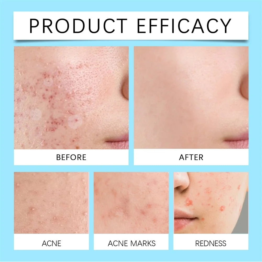 Retinol Face Wash Gel – Deep Pore Cleansing for Oily Skin