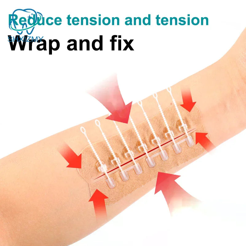 Zipper Wound Closure Patch – Hemostatic Bandage No Suture