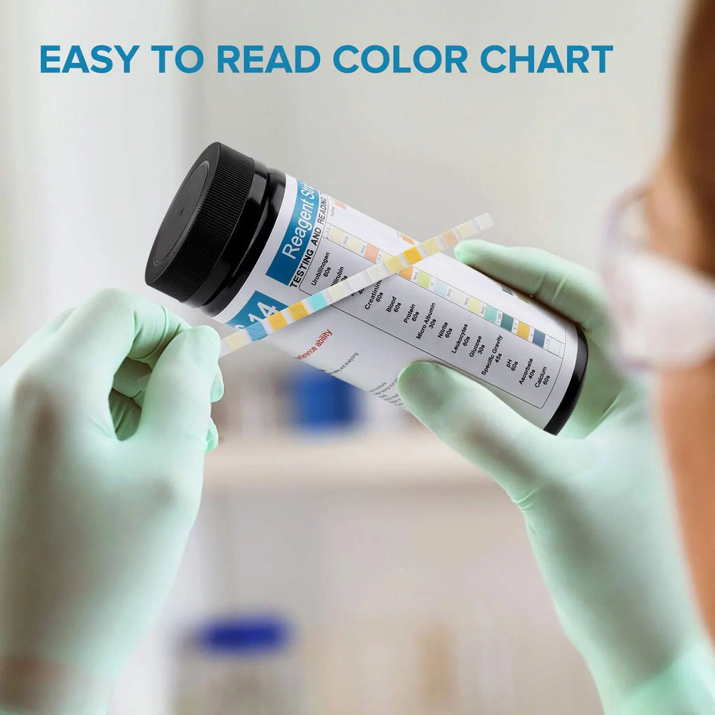 VIBE 100-Pc Multi-Parameter Urine Reagent Test Strips