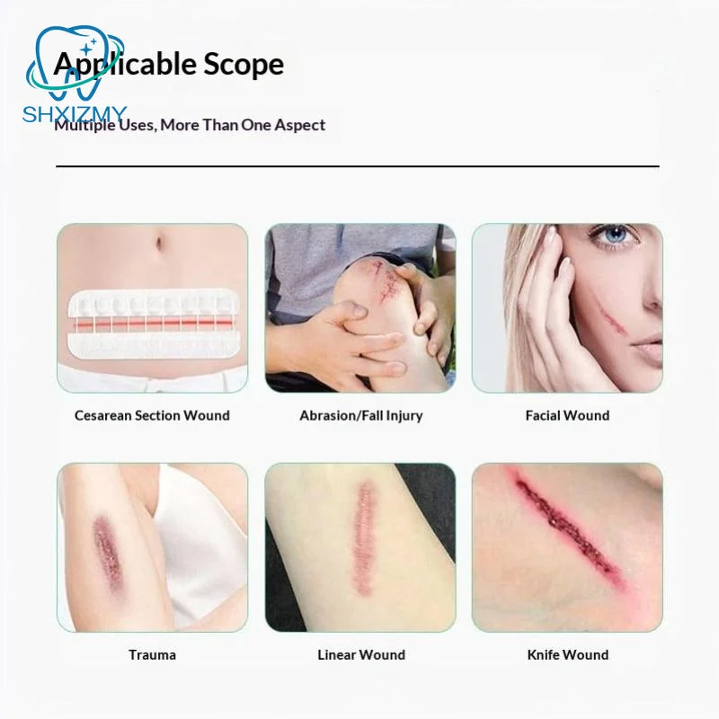 Suture-Free Wound Closure Strips | Zipper Bandage Patch
