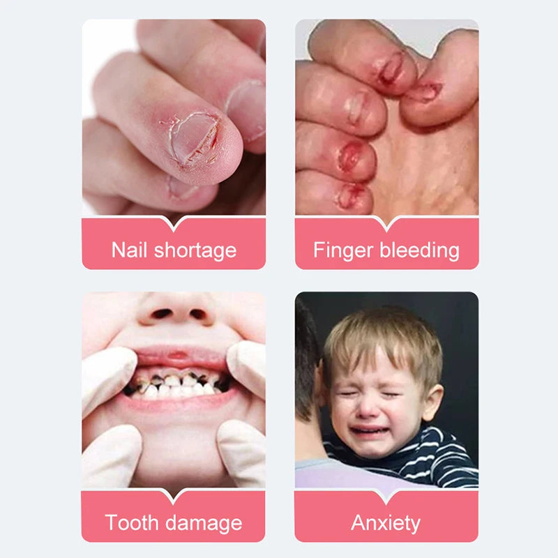 Aleekit 10ml Stop Nail Biting Treatment Liquid – Kids & Adults