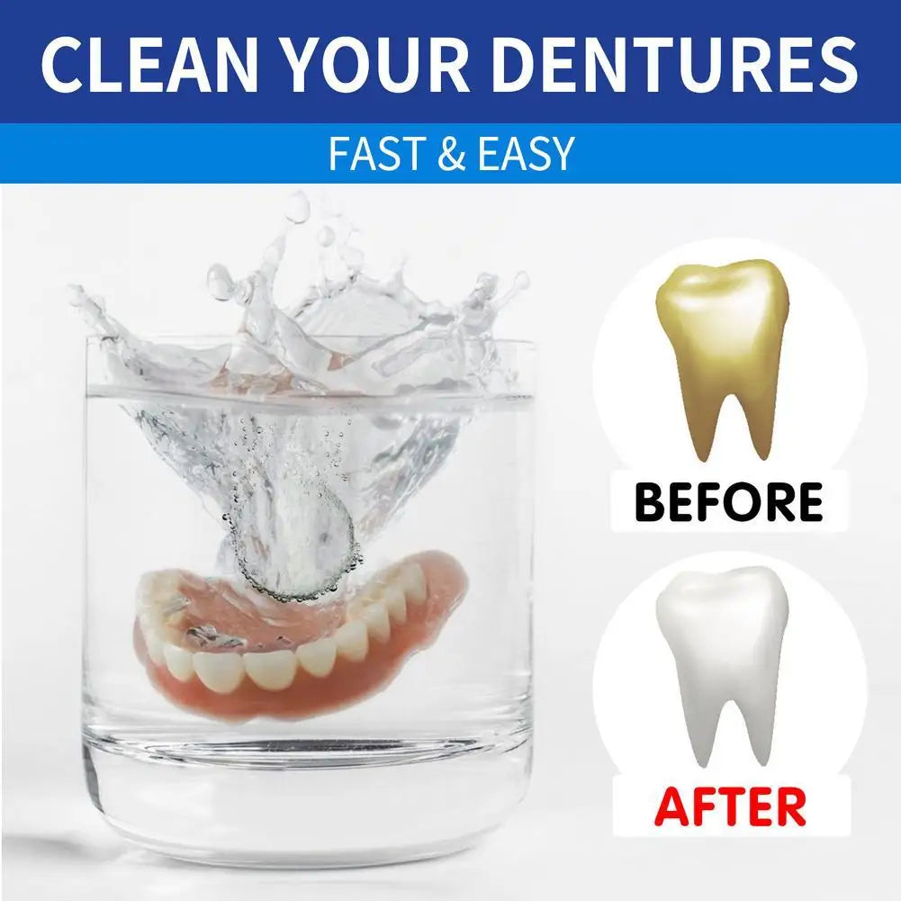 100-Pc Denture Cleaning Tablets – Stain & Plaque Remover