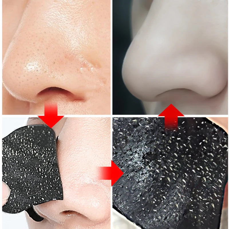 Nose Pore Cleansing Strips – Deep Pore Care 10–100 PCS
