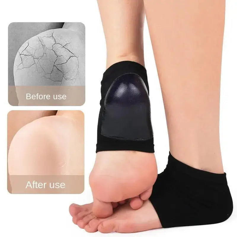 Moisturizing Silicone Heel Socks – Dry & Cracked Heel Care