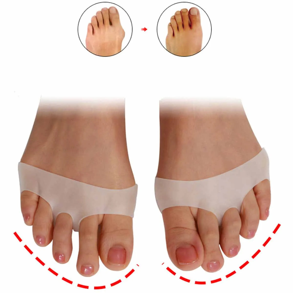 Silicone Gel Toe Pads Forefoot Cushion & Separator – 1 Pair