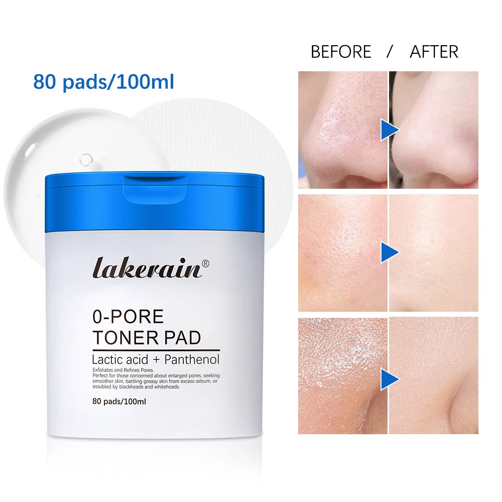 Zero Pore Toner Pads – Oil Control, Exfoliate & Refine Pores