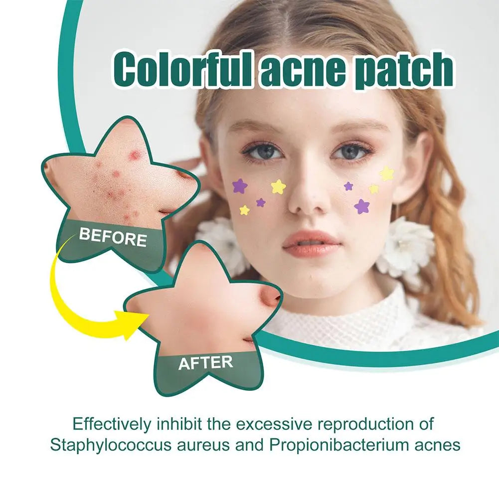 Invisible Pimple Patches – Oil Control Blemish Spot Stickers