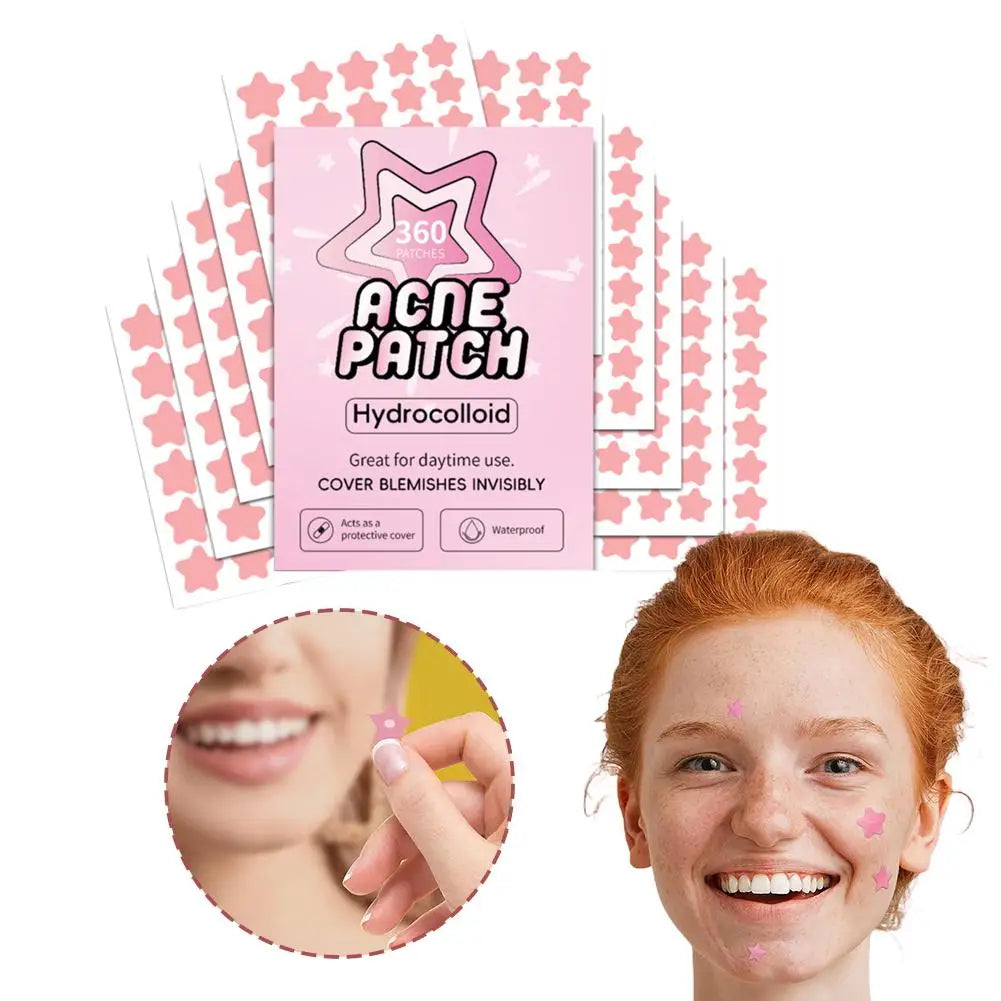 Colorful Star Pimple Patches – Fun Shaped Spot Stickers