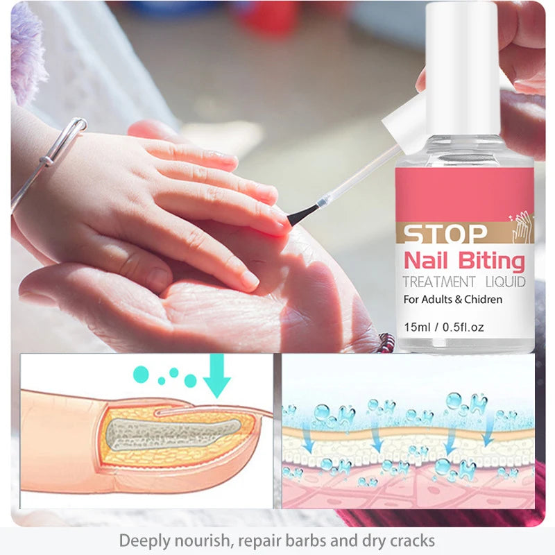 Aleekit 10ml Stop Nail Biting Treatment Liquid – Kids & Adults