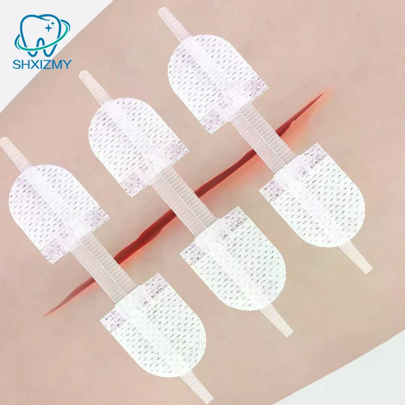 Zipper Wound Closure Patches – Elastic Breathable Bandage
