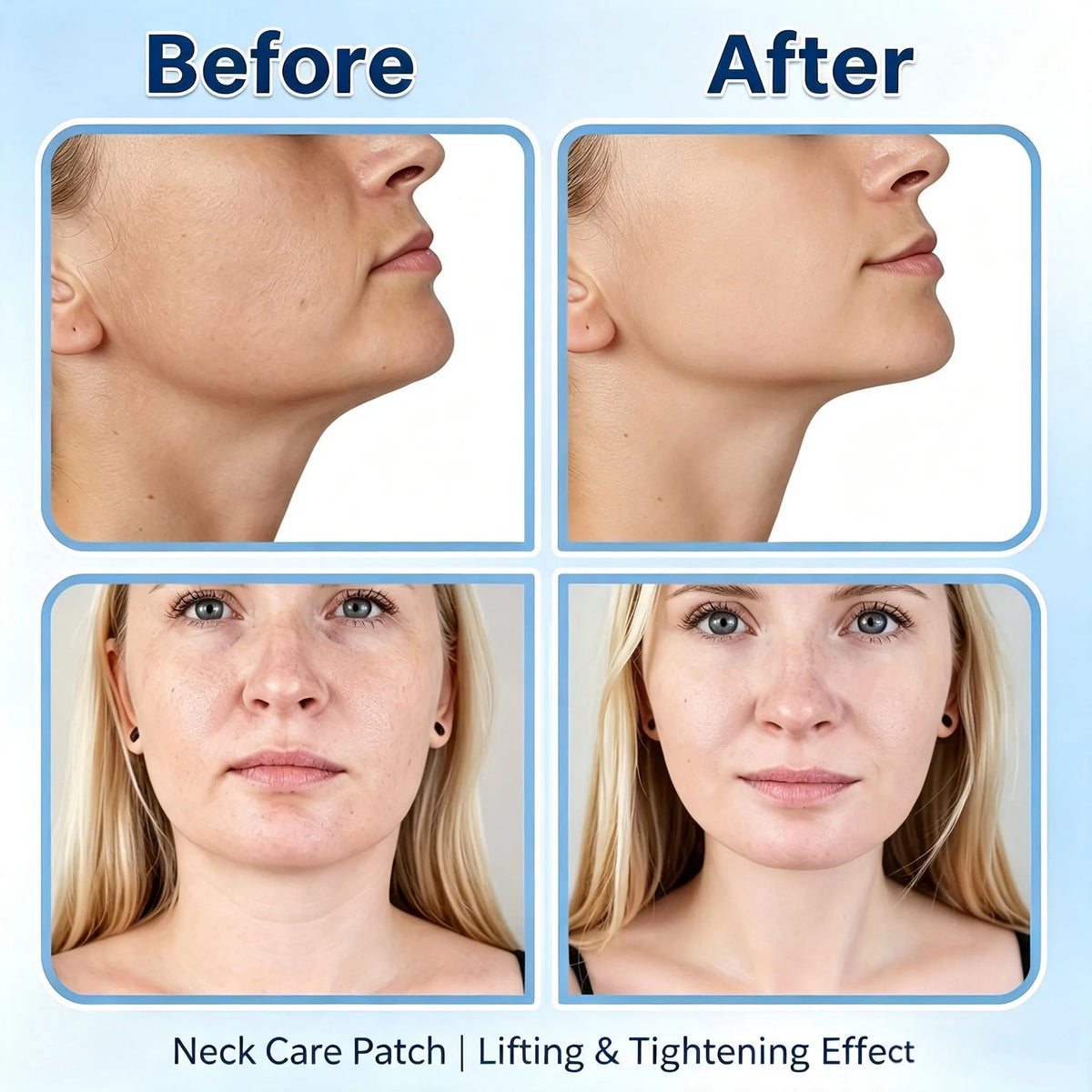 Neck Lifting Patches – Invisible Hydrogel Firming Strips 30/50 Pc