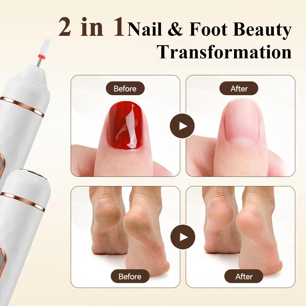 AFDEAL 2-in-1 Electric Nail Drill & Callus Remover Kit