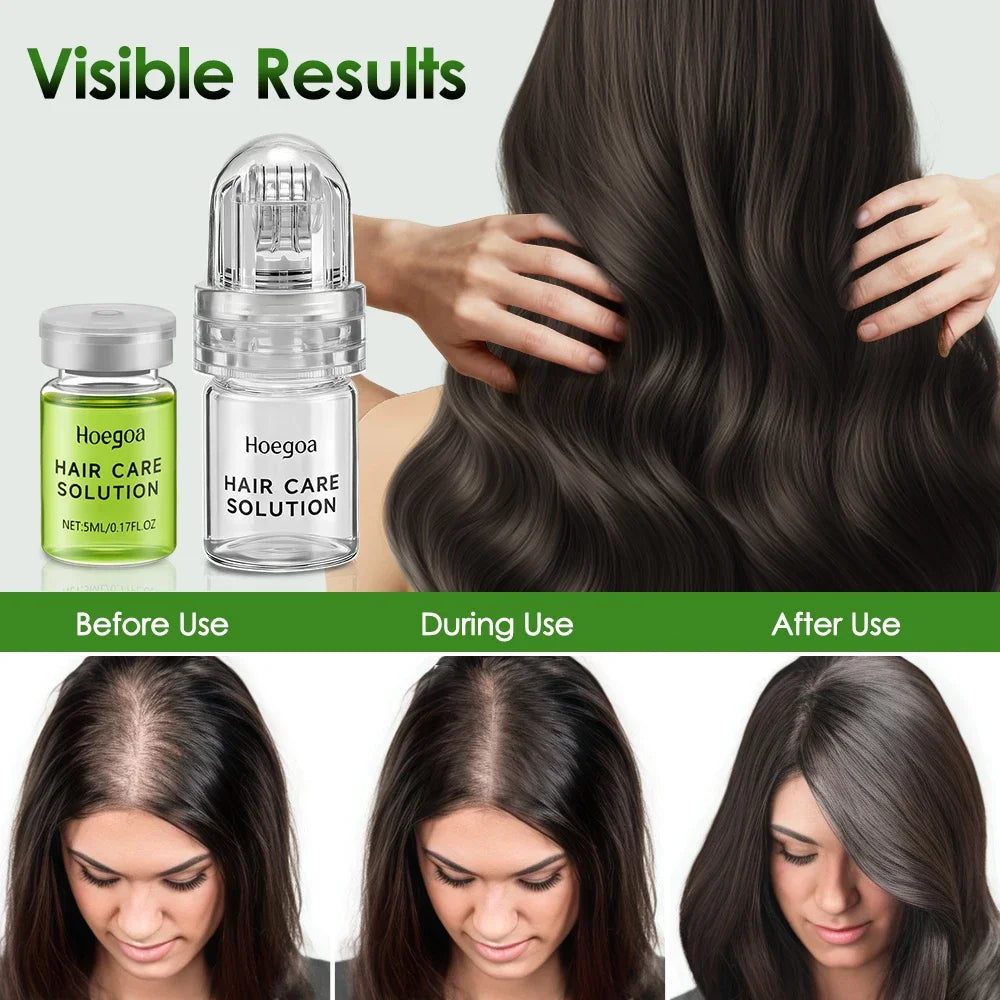Hailicare Hair Growth Serum Kit – Nourishing Scalp Essence