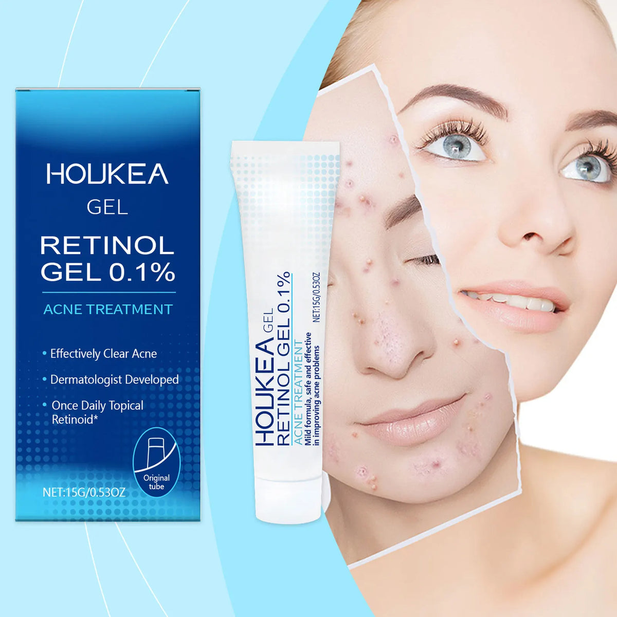 Retinol Face Wash Gel – Deep Pore Cleansing for Oily Skin