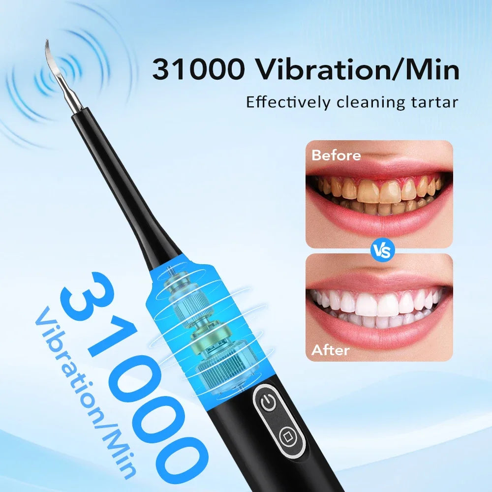 2-in-1 Electric Dental Scaler & Toothbrush | Plaque Remover Kit